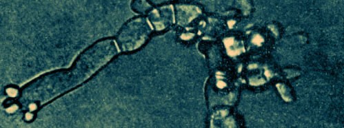 The Biological Problem of Cancer