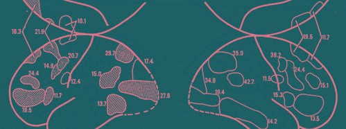 Pattern Recognition Mechanisms