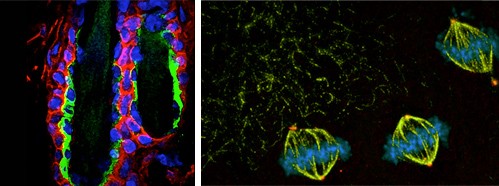 New Developments in Stem Cell Research: Induced Pluripotent Stem Cells and their Possible Applications in Medicine